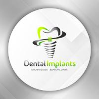 Centro Odontologico Dental Implants