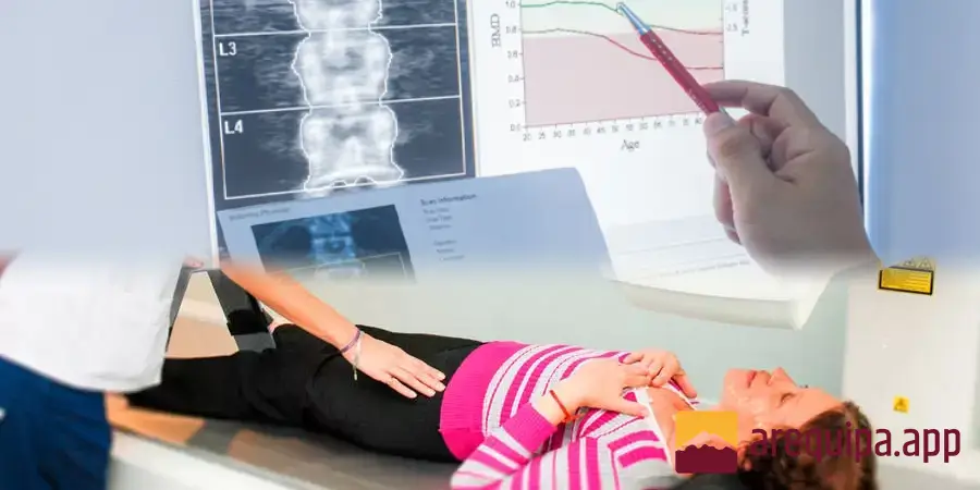 Densitometría ósea: ¿Cómo saber si tienes osteoporosis?