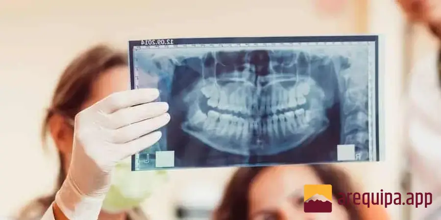 ¿Para qué sirve una radiografía y cuándo se recomienda?